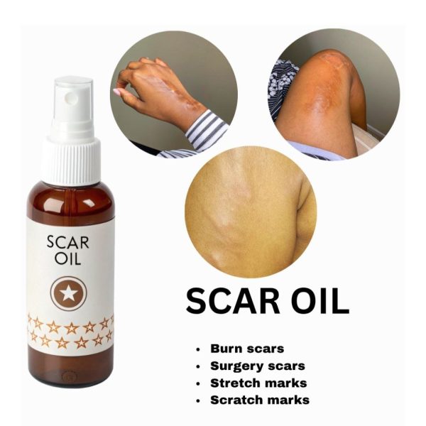 Scar Oil for Burn Scars and Stretch Marks